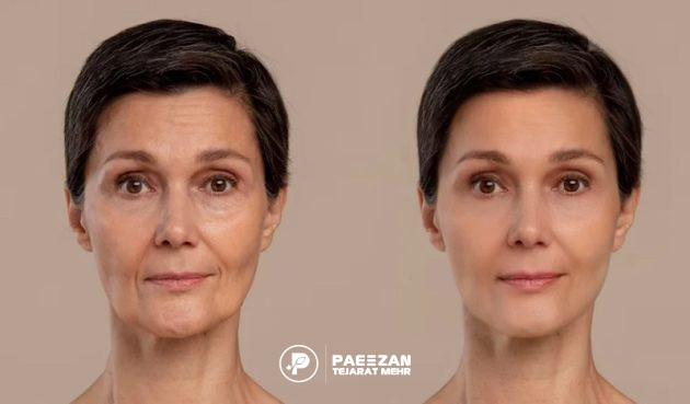 پیری زودرس