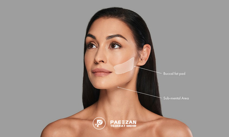 افتادگی پوست صورت بعد از لاغری