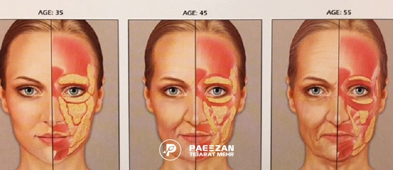 sagging wrinkles