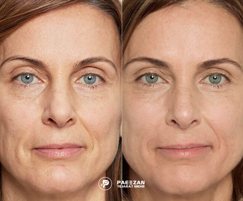 برترین ژل جوانساز دنیا
