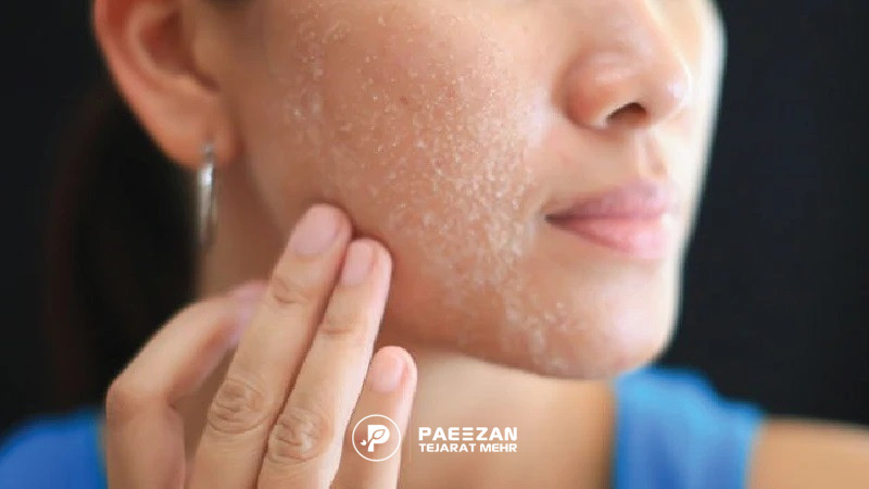 مراکز پروفایلو در استان تهران