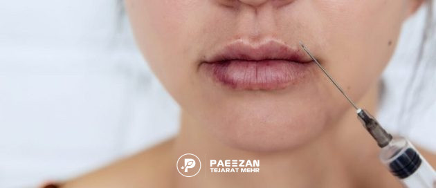 پروفایلو یا فیلر