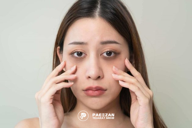 پروفایلو برای زیر چشم