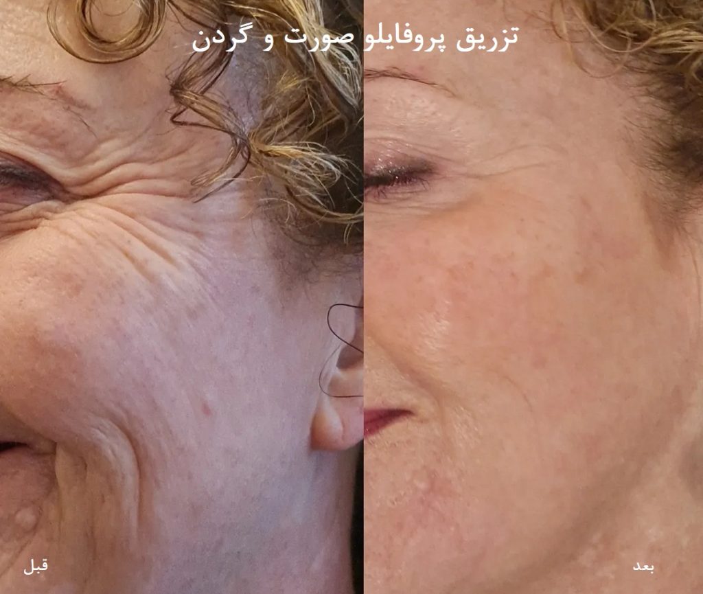 نظرات کاربران در مورد پروفایلو