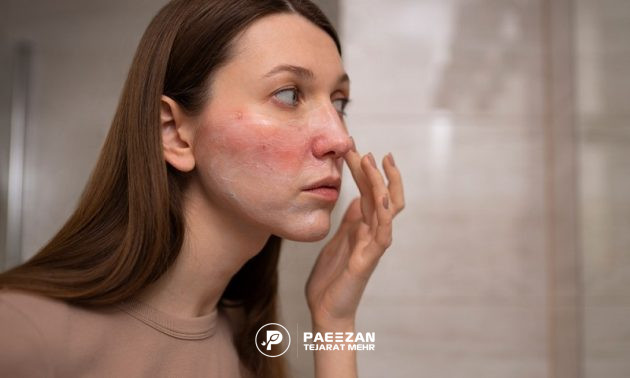 پروفایلو برای پوست‌های حساس