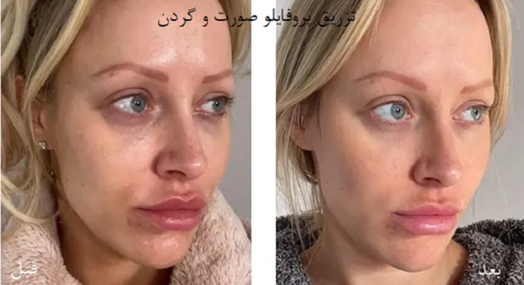 نظرات کاربران در مورد پروفایلو