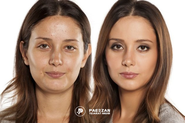 پروفایلو برای پوست‌های چرب