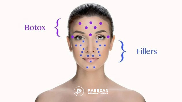 بوتاکس یا فیلر؟