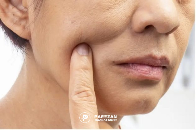 پیشگیری از عوارض آمپول لاغری اوزمپیک با پروفایلو 1 عوارض آمپول لاغری اوزمپیک