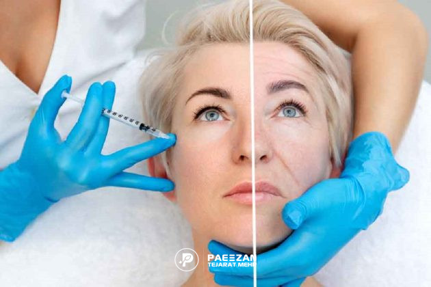 قیمت پروفایلو در سال ۱۴۰۴ + هزینه تزریق و قیمت هر سیسی پروفایلو 1 قیمت پروفایلو