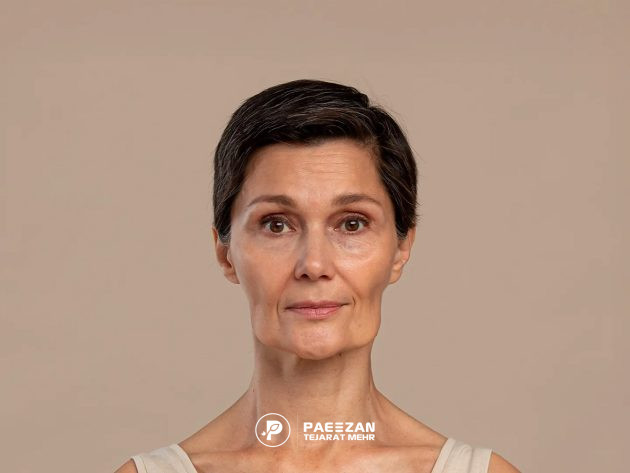 پیشگیری از عوارض آمپول مانجارو با تزریق پروفایلو 3 زن میانسال لاغری که پوست صورت او چروک و افتادگی زیادی دارد