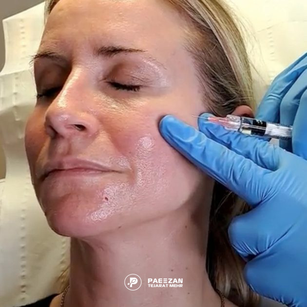 راهنمای شستن صورت بعد از تزریق پروفایلو 2 شستن صورت بعد از تزریق پروفایلو
