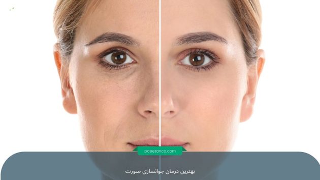 بهترین درمان برای جوانسازی پوست 3 بهترین درمان برای جوانسازی پوست