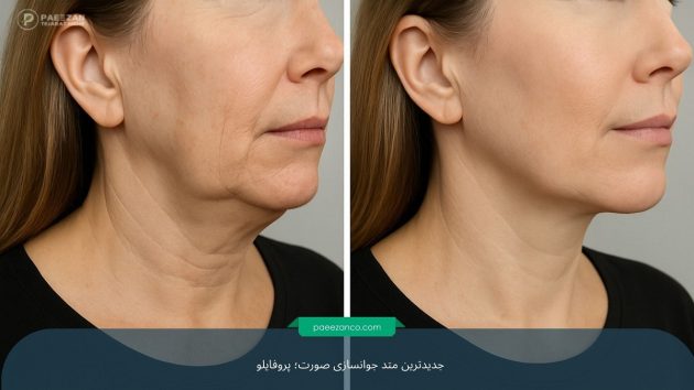 جدیدترین متد جوانسازی صورت 2 جدیدترین متد جوانسازی صورت