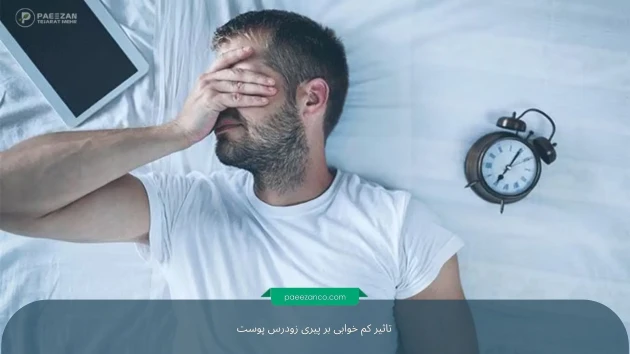 آیا خواب ناکافی باعث پیری زودرس میشود؟ 1 آیا خواب ناکافی باعث پیری زودرس میشود؟