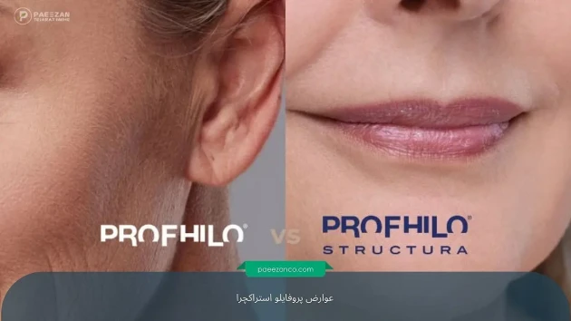 عوارض پروفایلو استراکچرا 2 عوارض پروفایلو استراکچرا