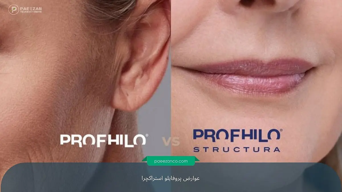 عوارض پروفایلو استراکچرا