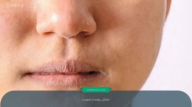 راهنمای درمان خشکی پوست صورت 1 خشکی پوست صورت