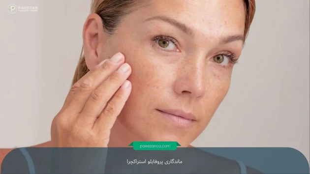 ماندگاری پروفایلو استراکچرا چقدر است؟ 2 ماندگاری پروفایلو استراکچرا