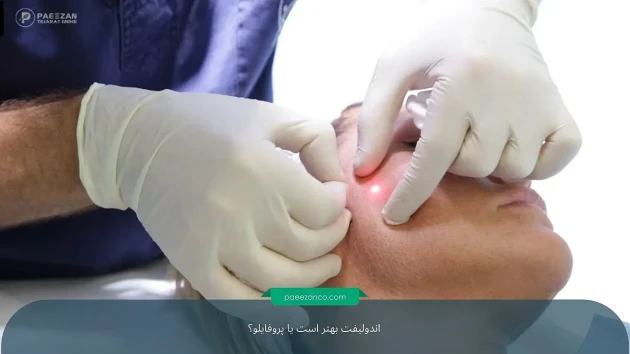 اندولیفت بهتر است یا پروفایلو؟