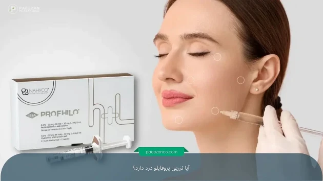 صورت دختری که نقاط تزریق پروفایلو با دایره روی صورت او مشخص شده است و دست پزشک که سرنگ پروفایلو را کنار صورت دختر نگه داشته است. در سمت چپ تصویر هم یک جعبه پروفایلو قرا دارد