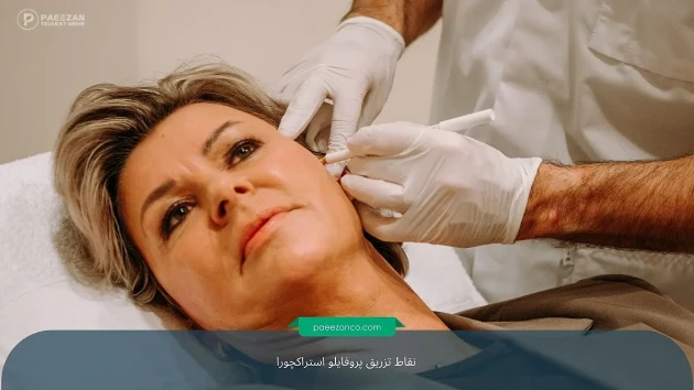 آشنایی با نقاط تزریق پروفایلو استراکچورا 1 نقاط تزریق پروفایلو استراکچورا