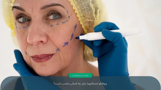 پروفایلو استراکچورا برای چه کسانی مناسب است؟