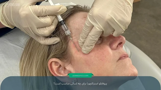 پروفایلو استراکچورا برای چه کسانی مناسب است؟