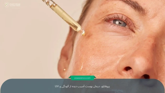 درمان پوست خسته و آسیب دیده از آلودگی و UV 4 درمان پوست خسته و آسیب دیده از آلودگی و UV