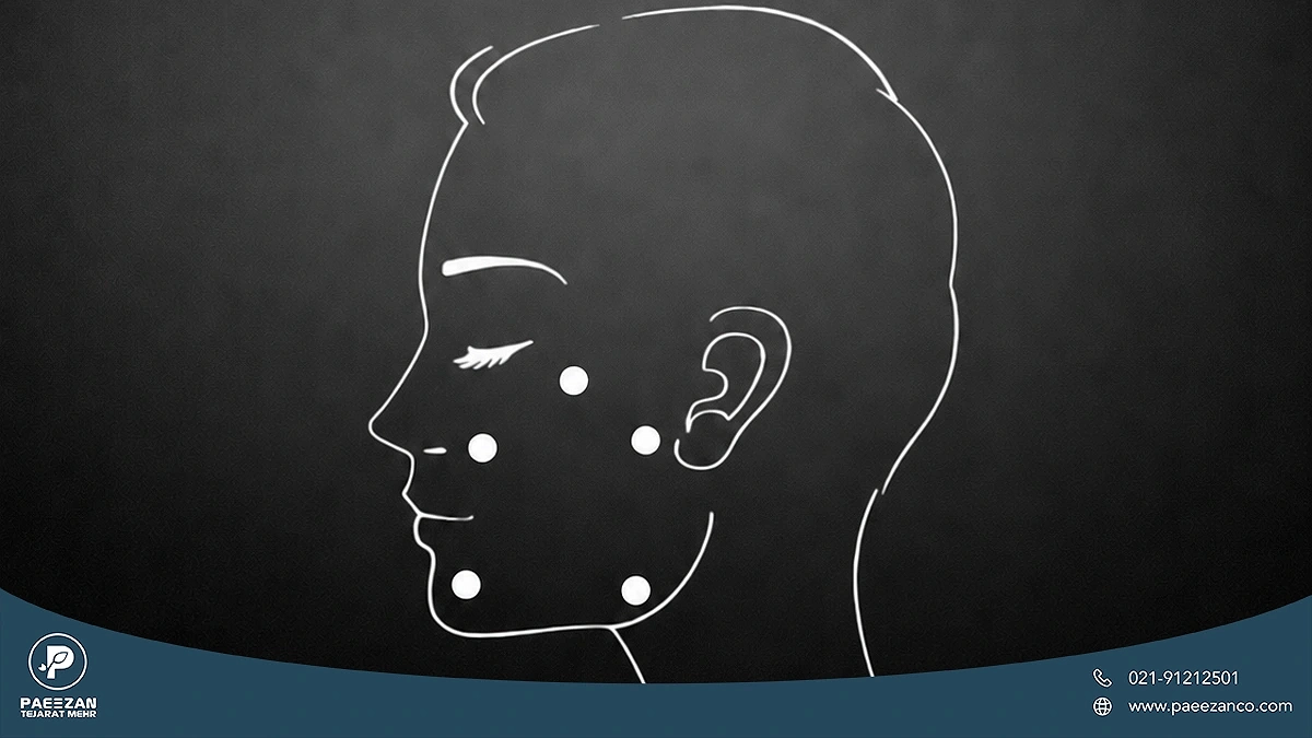 اینفوگرافیک صورت دختری که نقاط تزریق پروفایلو با تکنیک BAP با نقاط سفید روی صورت او مشخص شده است