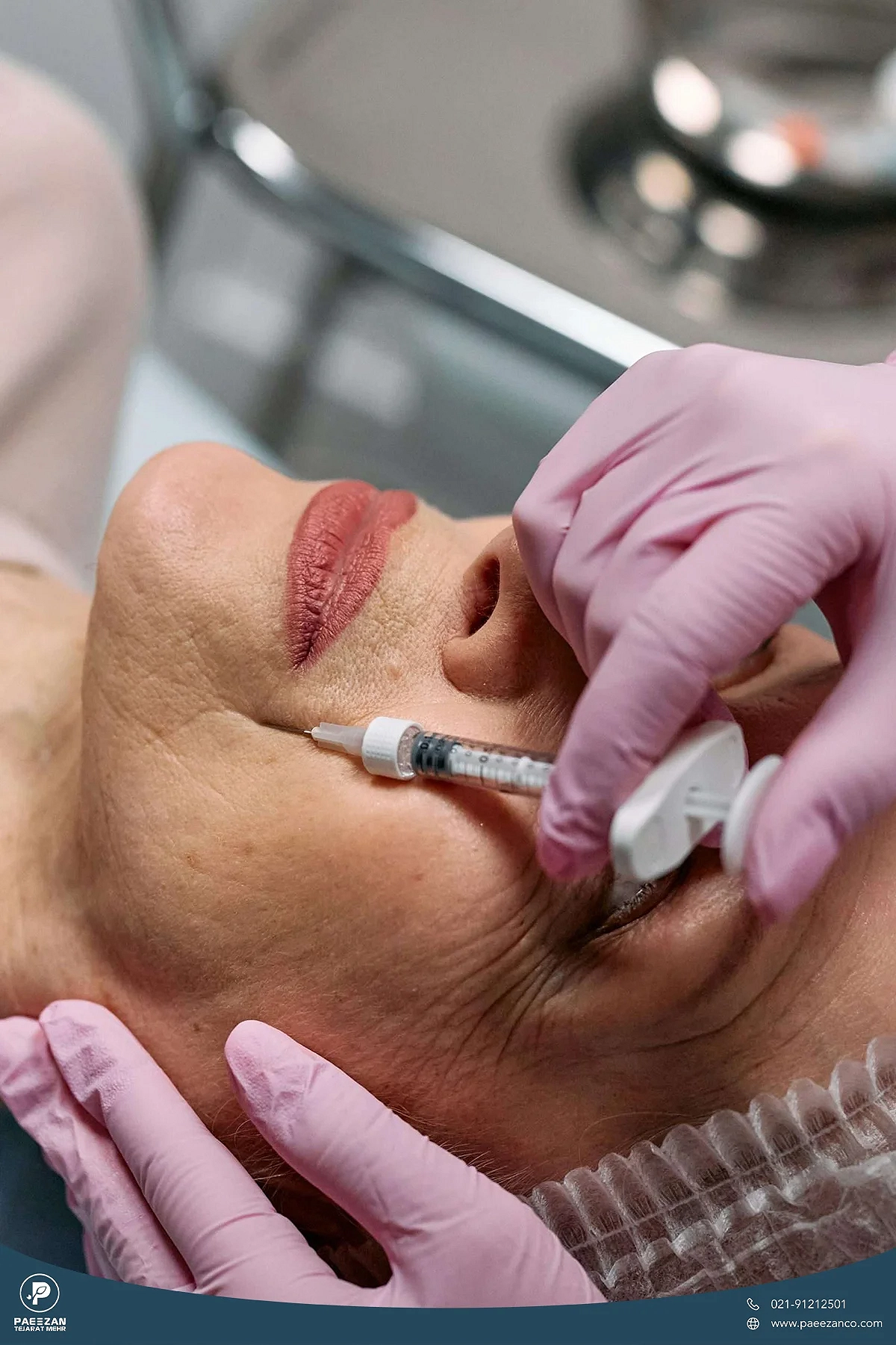 راهنمای جوانسازی صورت در یک جلسه 3 عکس نزدیک از صورت خانمی که روی تخت دراز کشیده است و پزشک به خط خنده او پروفایلو تزریق می کند