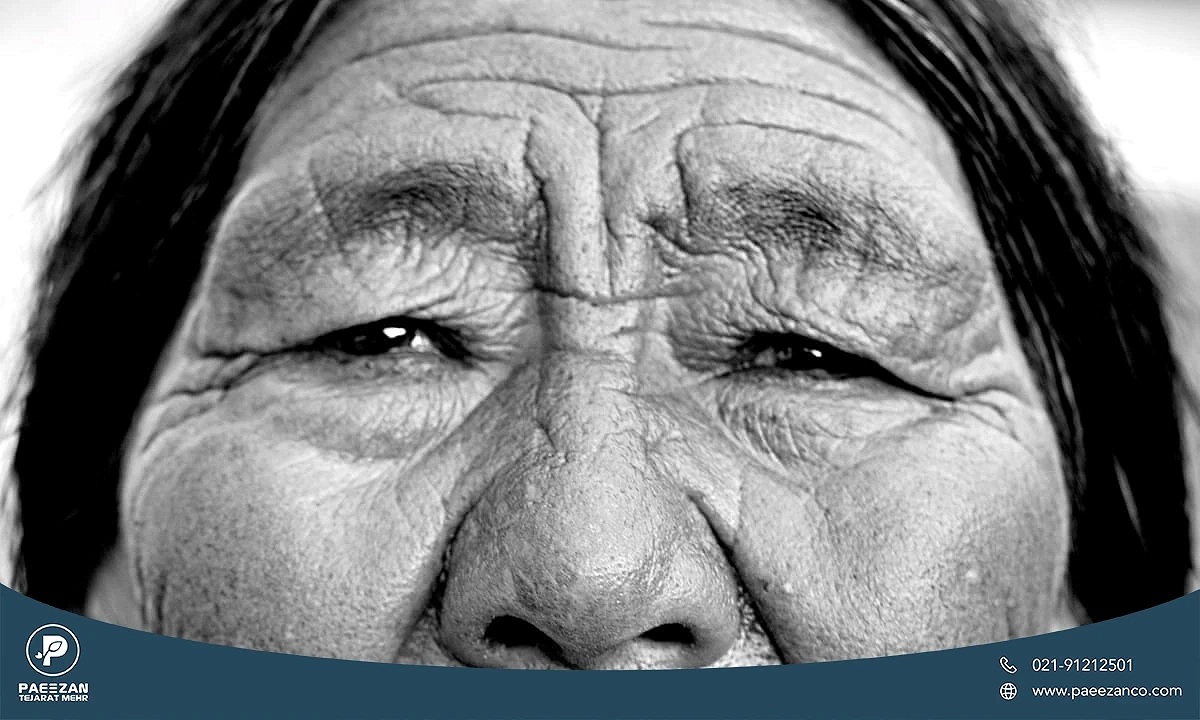 چه اشتباهاتی روند جوانسازی را کند می کند؟ 1 عکس از زن مسن که روی صورتش چروک های زیاد و عمیقی دارد