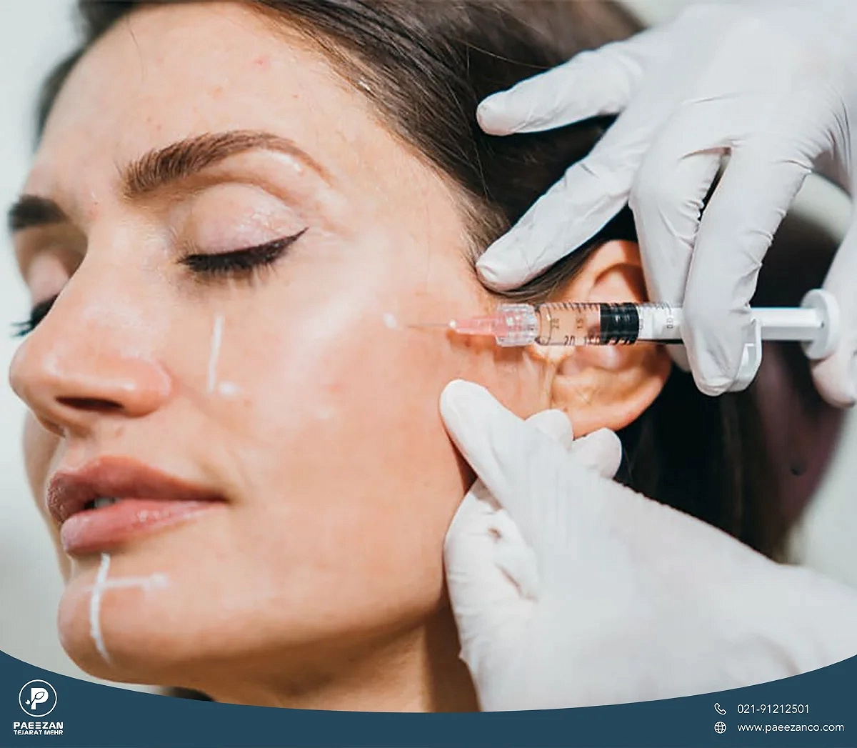 صورت دختری که پزشک به صورت او پروفایلو تزریق می کند