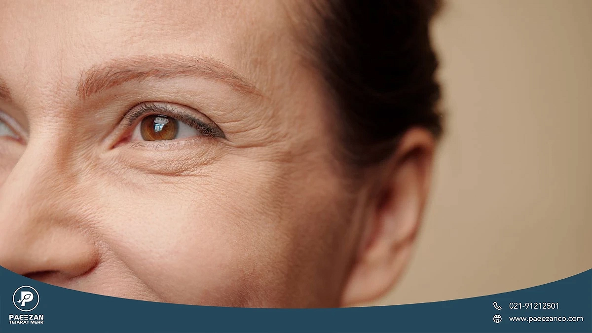 عکس نزدیک از صورت دختری زنی که روی بینی و دور چشمش چروک های ریزی دارد