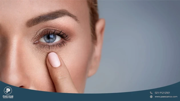 دختری که پوست زیر چشم او جوان و شاداب است و انگشت خود را زیر چشمش گرفته است