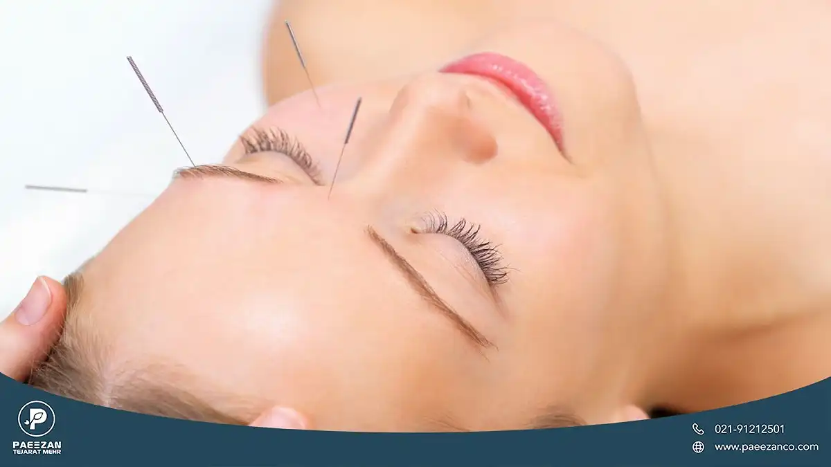 راهنمای جوانسازی پوست در طب سنتی 2 دختری که چشم خود را بسته و سوزن های طب سوزنی داخل پوست او است
