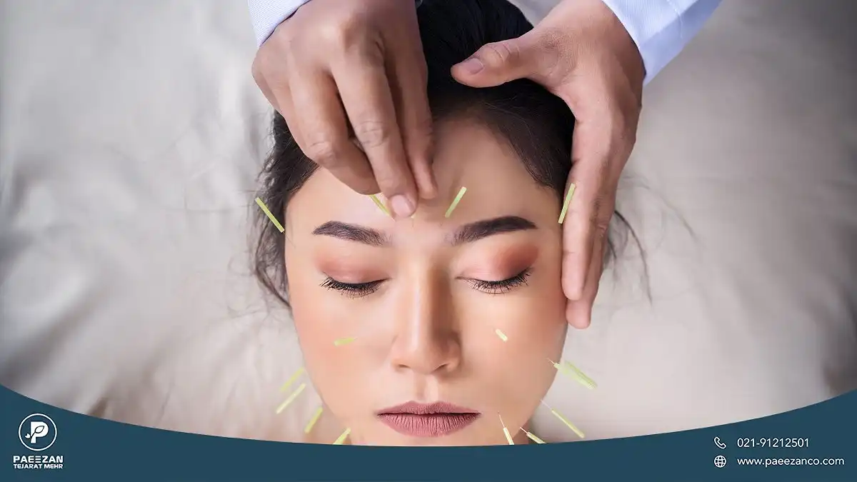 دختری که چشم های خود را بسته و فردی روی پوست صورت او طب سوزنی انجام می دهد