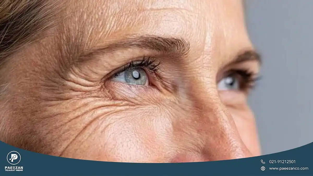 عکس نزدیک از چشم های زنی که اطراف چشم هایش خطوط پنجه کلاغی ایجاد شده است